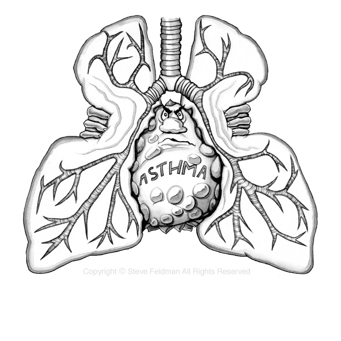 Mean Asthma Meanie Squeezing Lungs cartoon